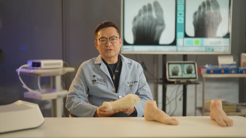 Cadara Foot for surgeons — film still